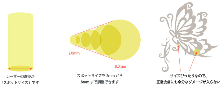 エンライトンⅢの特徴３