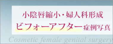 婦人科形成症例写真