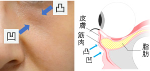 黒クマ