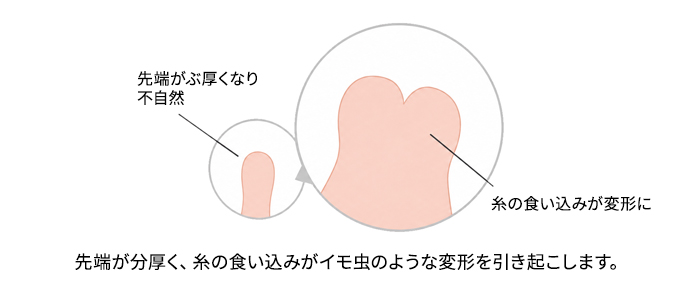 一般的な手術方法2