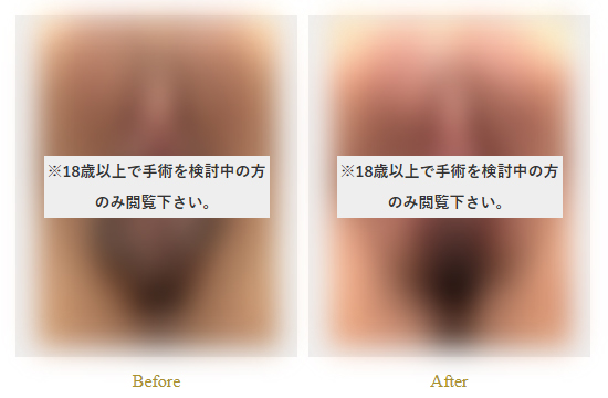症例写真