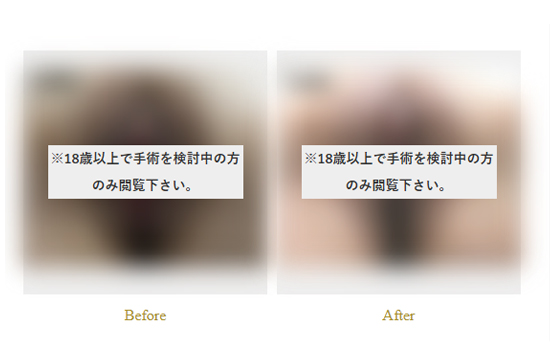 症例写真
