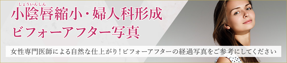 切除 写真 しょう 症例 いん しん