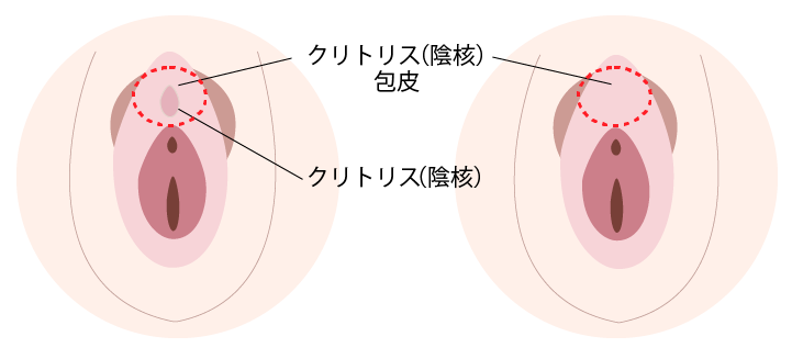 クリトリス露出 FANZA
