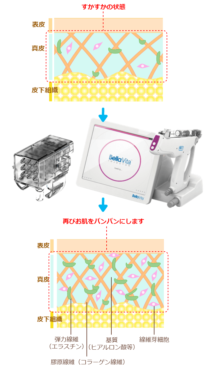 お肌をパンパンにします