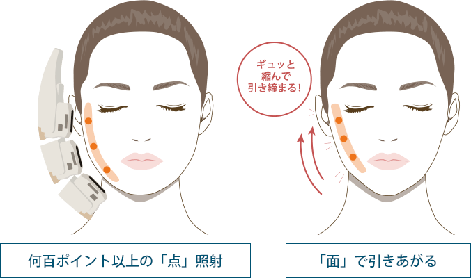 何百ポイント以上の「点」照射｜「面」で引きあがる