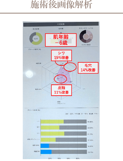 施術後画像解析