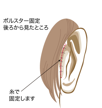 耳介軟骨移植 美容外科 皮膚科 婦人科形成のルーチェクリニック