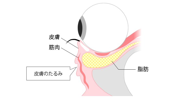 皮膚のタルミがでる仕組み