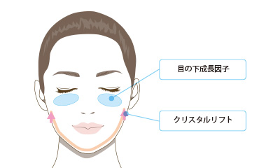 クリスタルリフト＋目の下成長因子