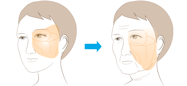 フェイスラインがたるむ仕組み