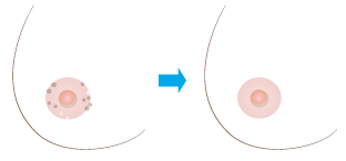 見た目を重視した自然なで美しい仕上がりを重視