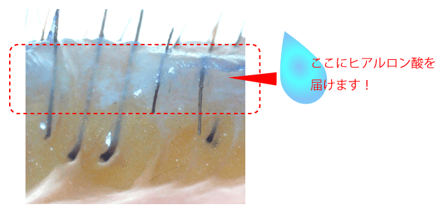 ここにヒアルロン酸を届ける