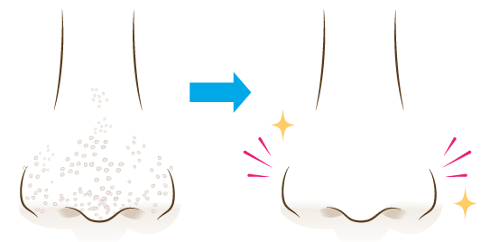 鼻へのボトックス注入とは