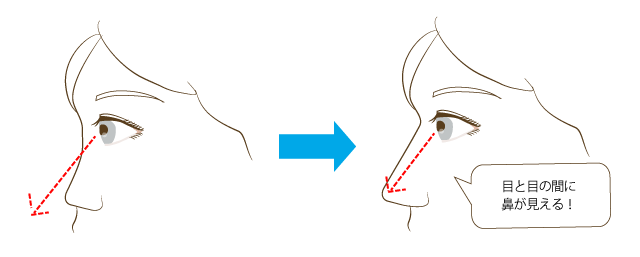1.鼻を高くできます。