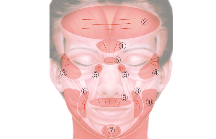 ボトックスの修正ができる部位