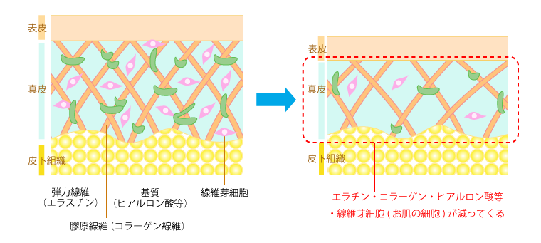 お肌の老化とは？