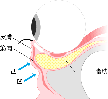 下瞼が膨らんでくる仕組み