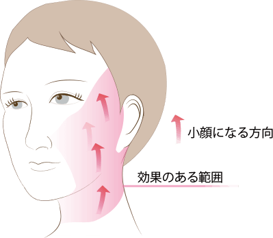 ハリツヤクリスタルリフトの手術方法