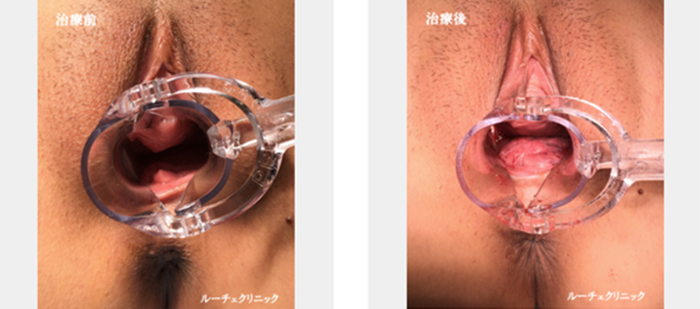 症例写真