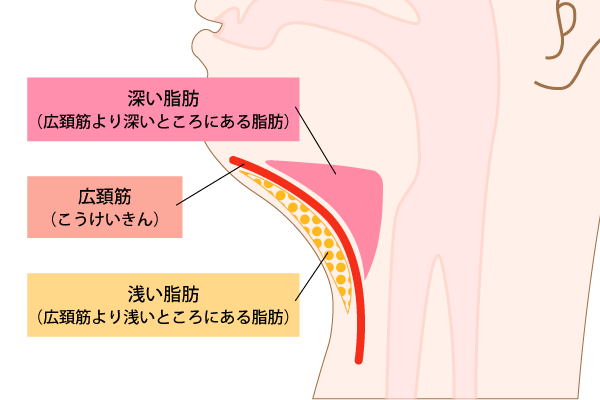 アゴ下リフト（アゴ下筋肉縛り）