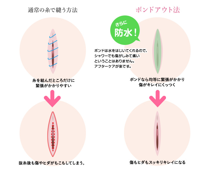 患者様お一人お一人にあった治療法をご提案致します。