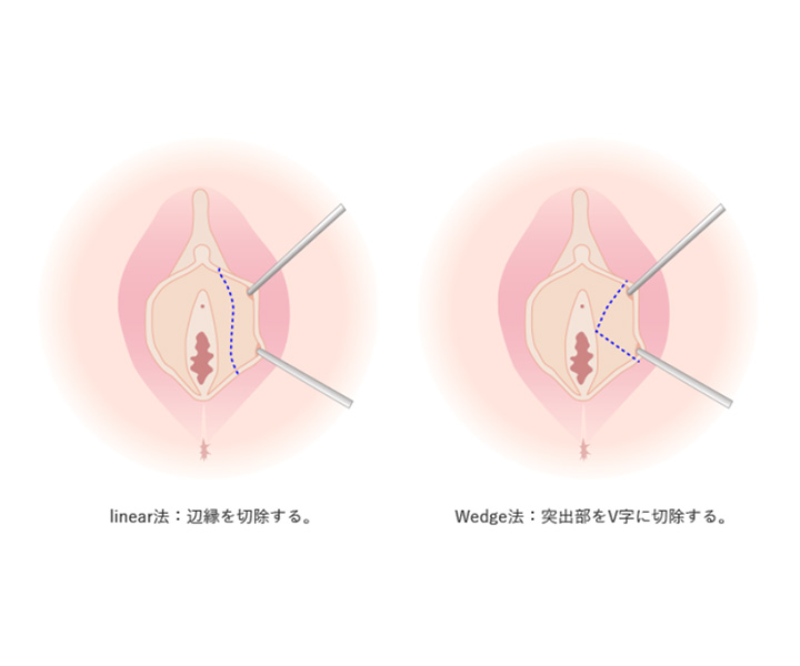 トータルビューティーに配慮した手術をご提案いたします。