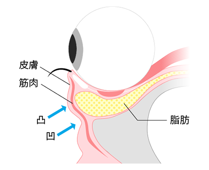 目元を横からみると