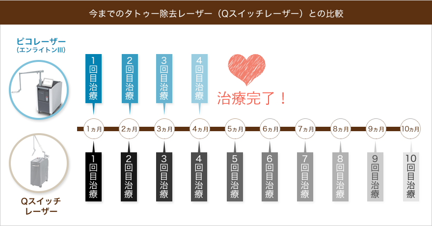 今までのタトゥー除去レーザー（QスイッチYAGレーザー）との比較