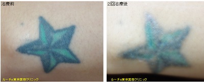 黒と緑の2色タトゥー