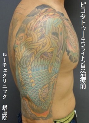 カラータトゥー　腕