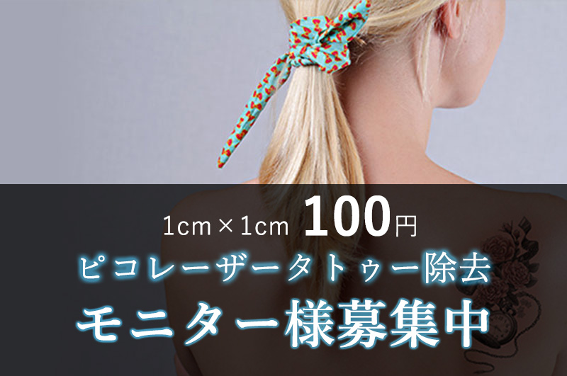 タトゥー除去ピコレーザー