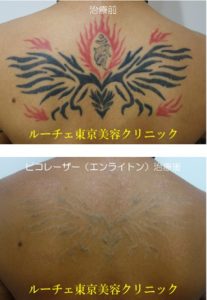 背中の濃いタトゥー