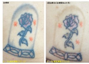 背中のカラータトゥー