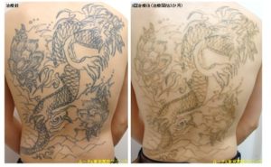 大きな背中のタトゥー