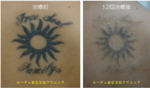 盛り上がりが強いタトゥー