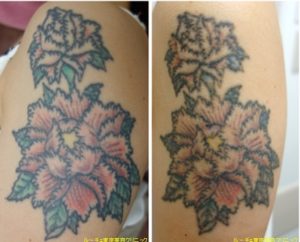 腕5色カラフルタトゥー