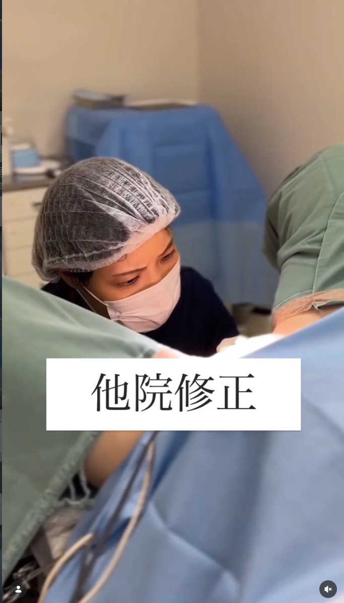 婦人科形成の失敗動画