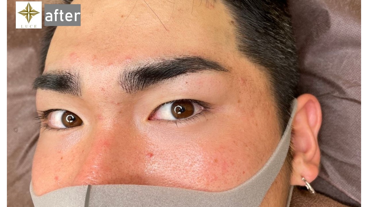 メンズ ３dアートメイク 美容外科 皮膚科 婦人科形成のルーチェクリニック