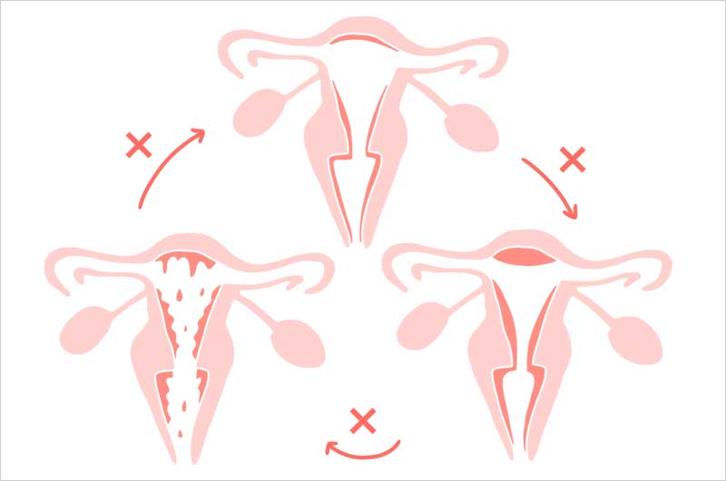 50代で膣脂肪注入する方へのイメージ画像