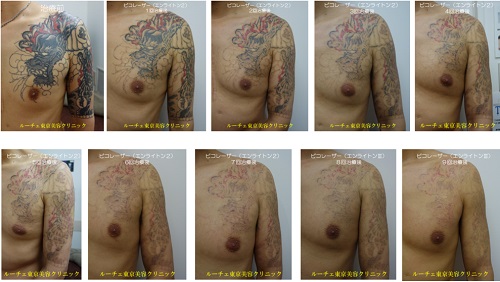 濃い赤と黒　9回、経過、とれた