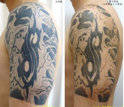 盛り上がりのある濃い黒