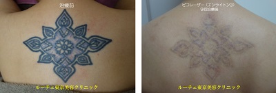 背中のカラータトゥー＿