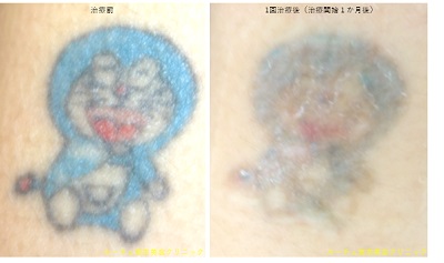 水色ピンク赤黒4色ドラえもん